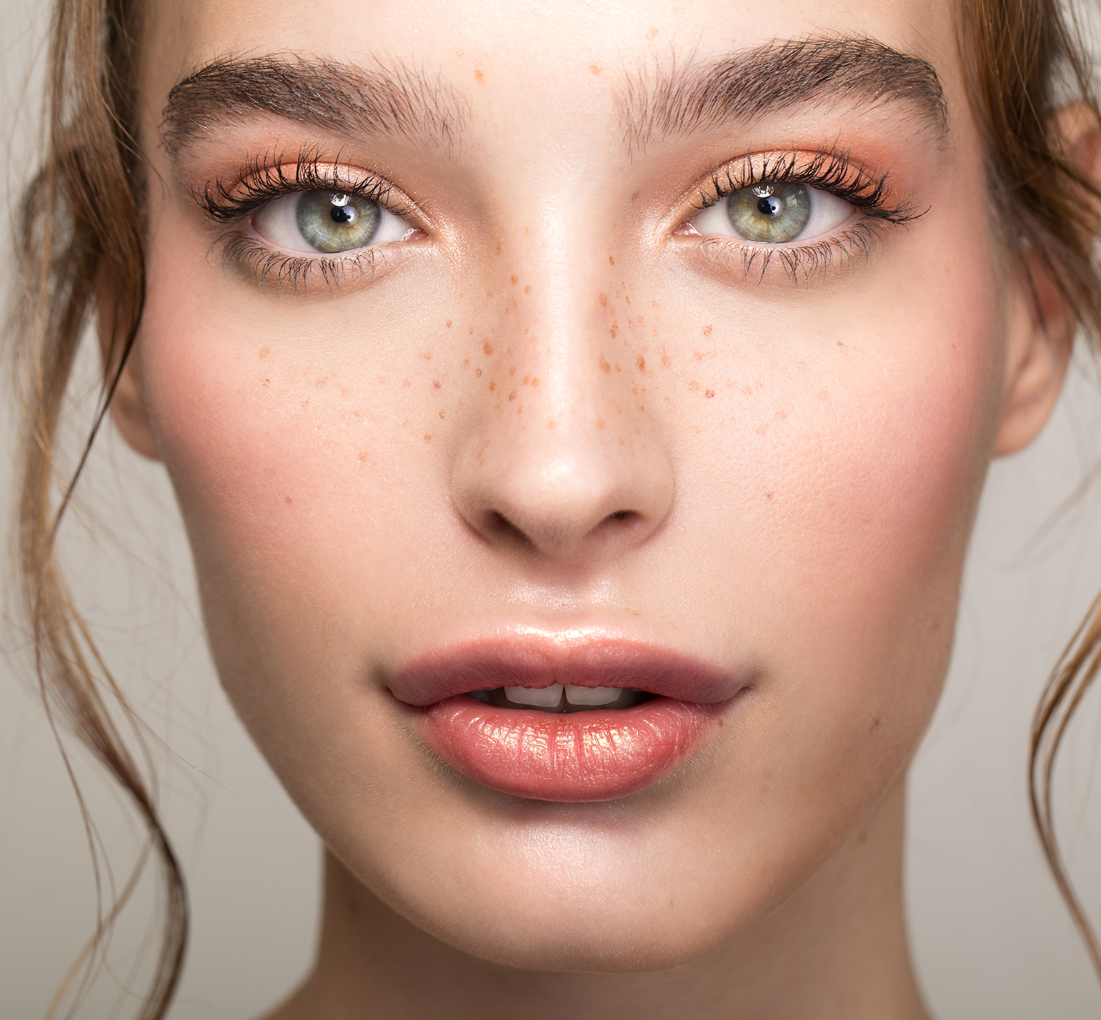 The Vila Institute for Plastic Surgery Blog | Are Lip Lifts Permanent? Exploring Long-Term Results