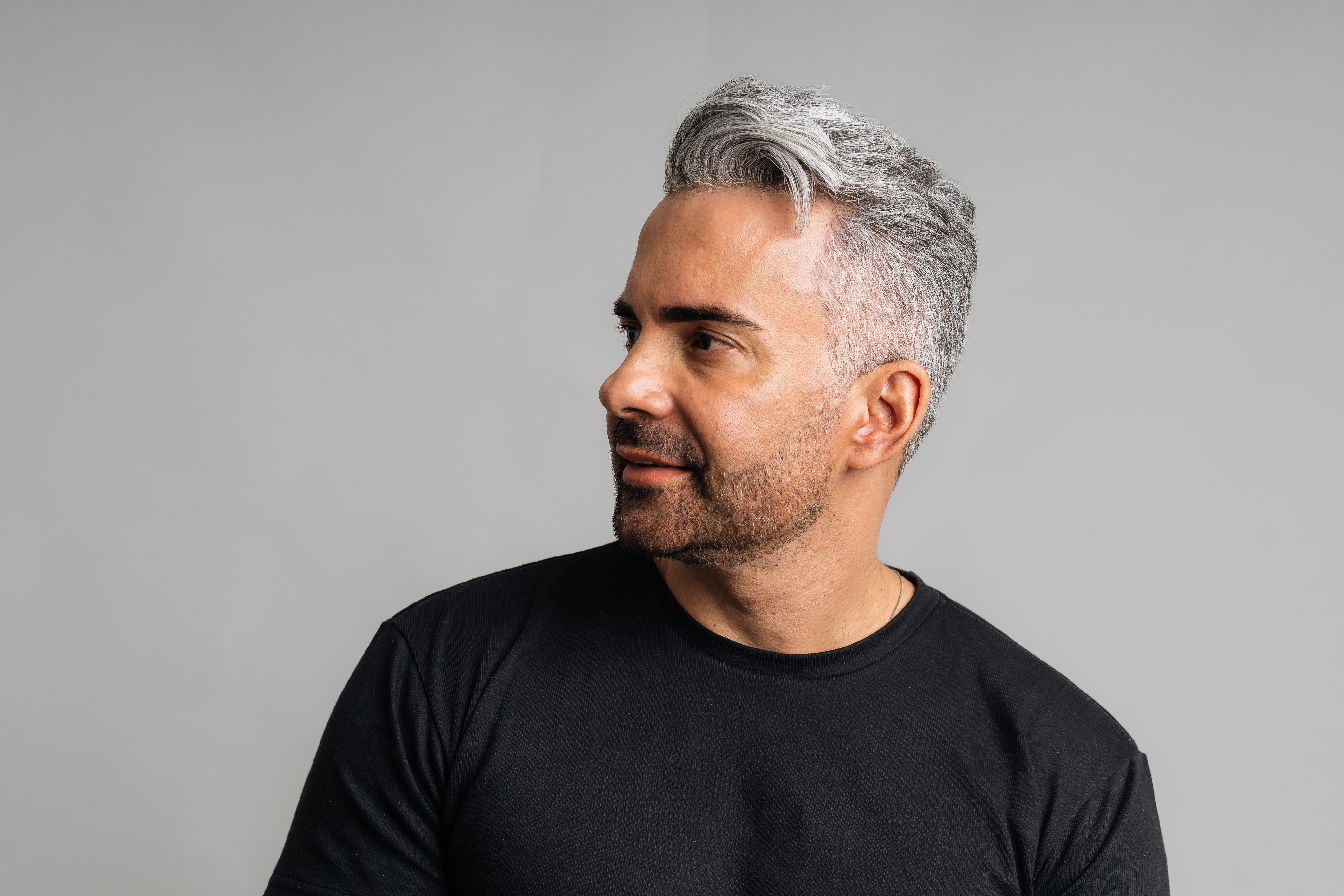 The Vila Institute for Plastic Surgery Blog | What is the Age Limit for a Hair Transplant?