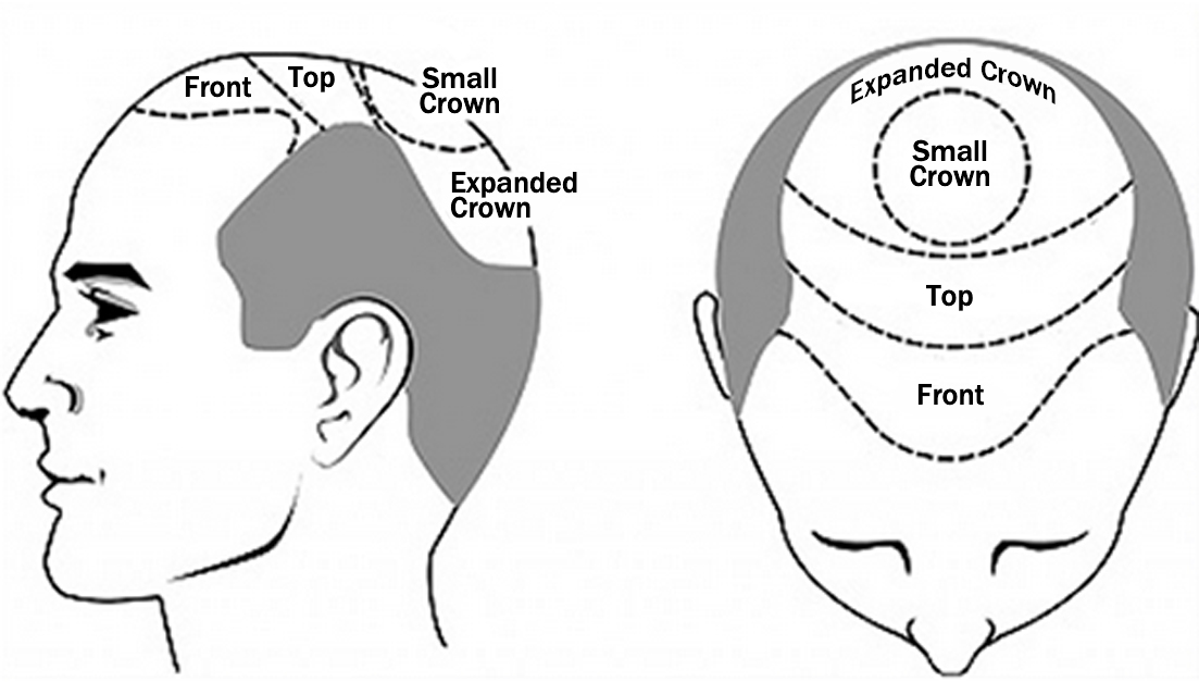 Scalp Zones