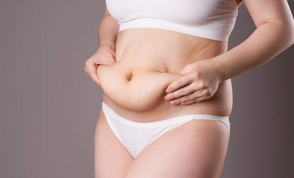 woman holding fold of skin on thick belly