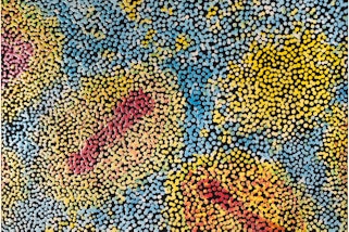An oil painting in portrait format showing magnified smallpox cells in red and yellow on a blue background.
