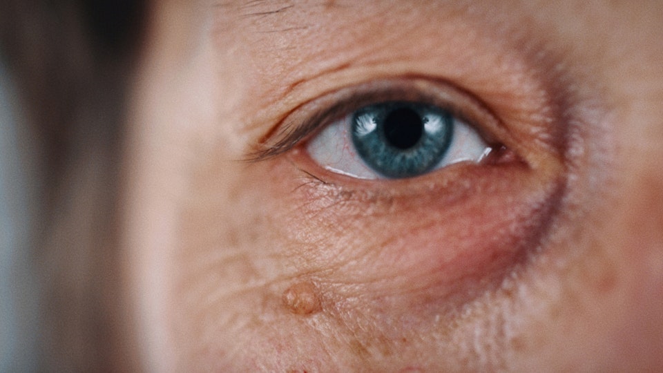 A close-up of a person's eye