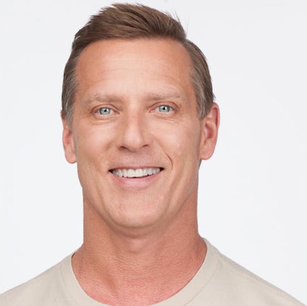 Botox Gallery Before & After Gallery - Patient 24400730 - Image 2