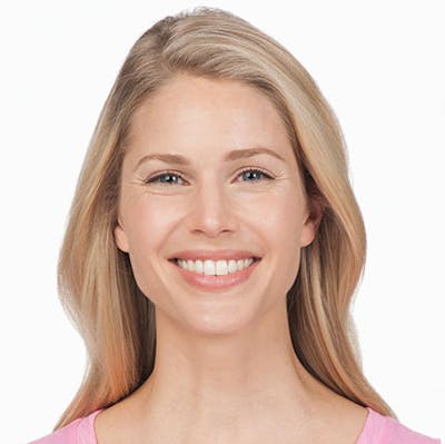 Botox Gallery Before & After Gallery - Patient 24400731 - Image 1
