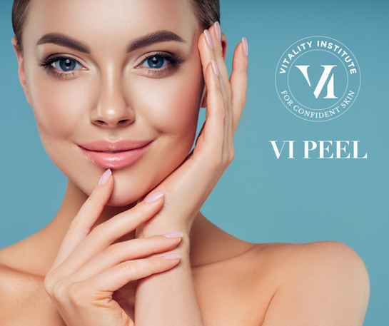 Vi Peel Banner