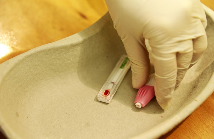 hepatită severă de cauză necunoscută 