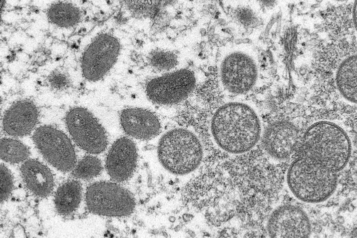 virus la microscop