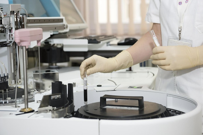 teste de laborator HPV.