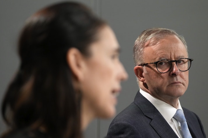 Anthony Albanese