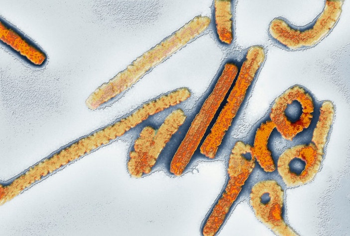 marburg boala virus