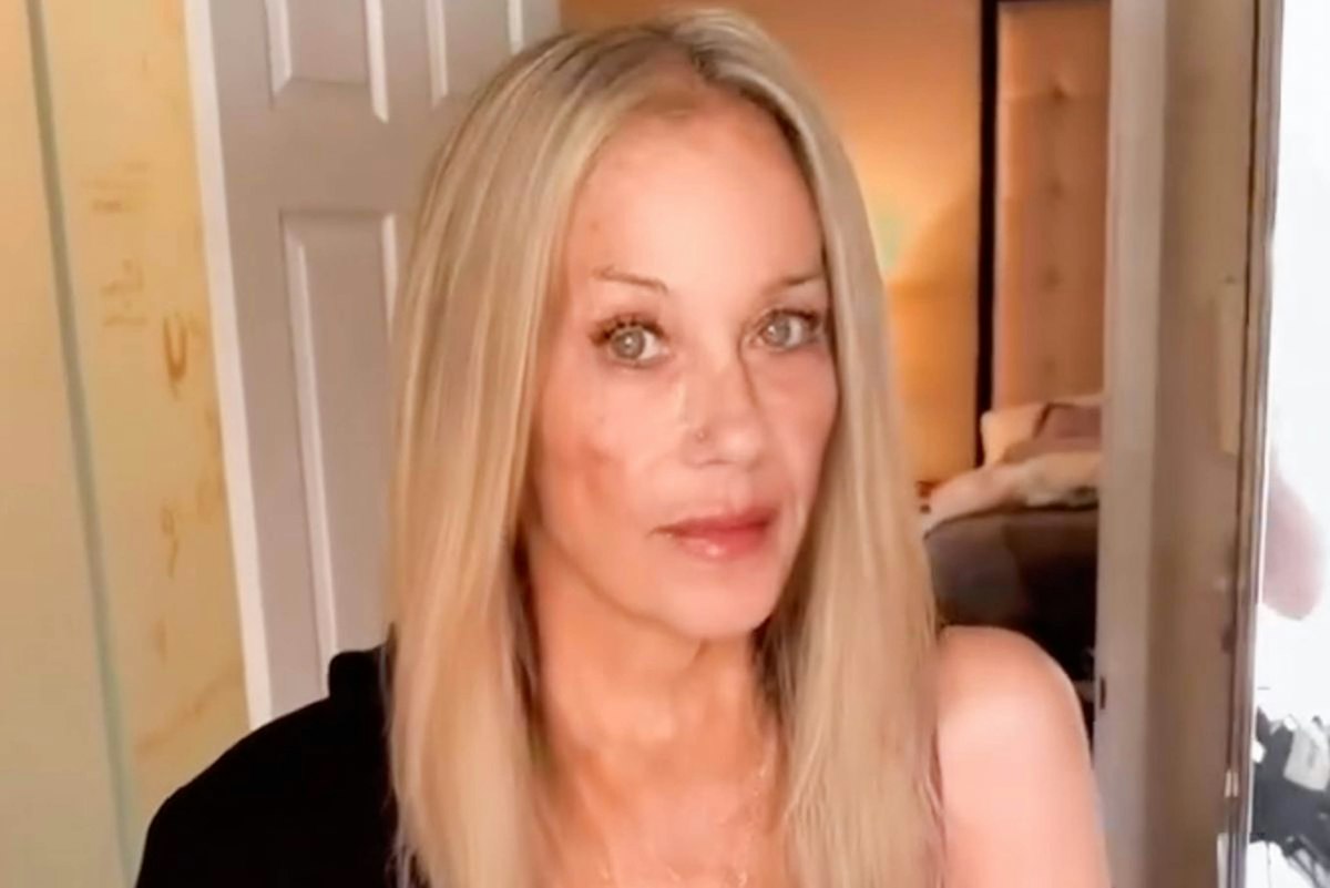 Christina Applegate confirmă diagnosticul greșit de scleroză multiplă