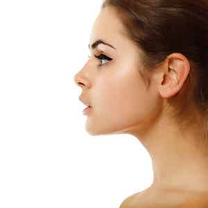 neck rejuvenation - photo woman