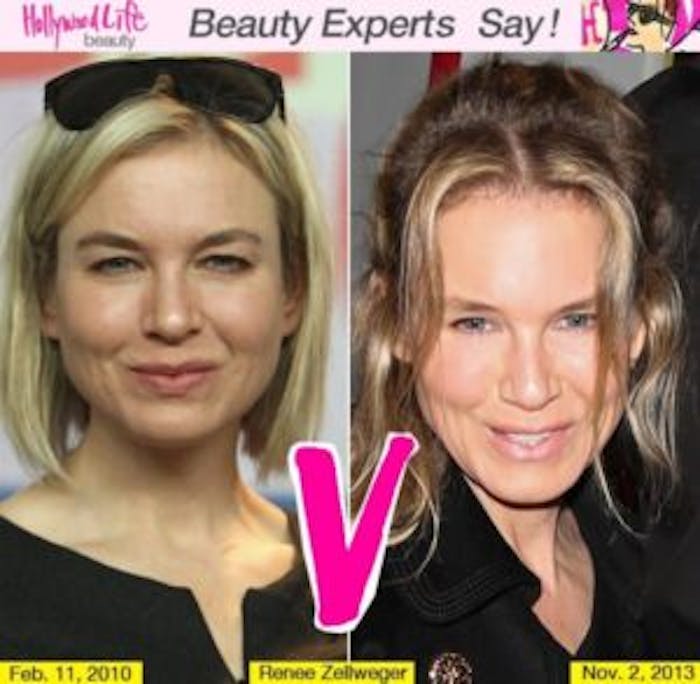 Zellweger