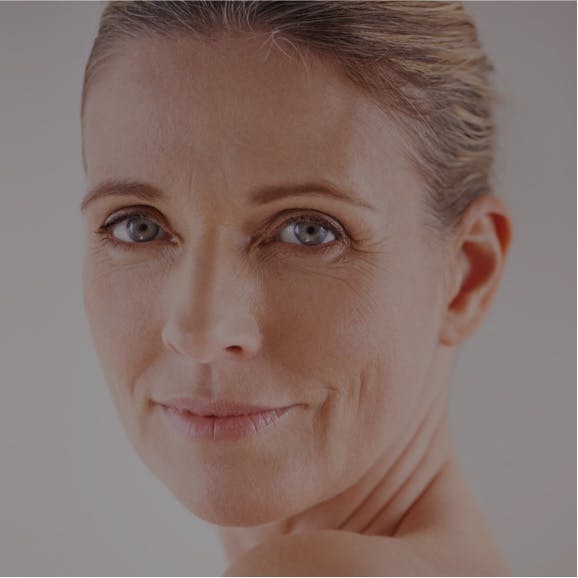 Facelift