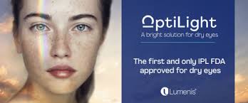 optilight banner