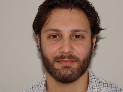 Hair Transplant Before & After Gallery - Patient 101410288 - Image 2