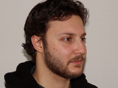 Hair Transplant Before & After Gallery - Patient 101410288 - Image 3