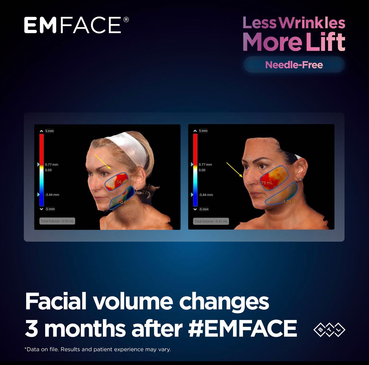 emface infographic