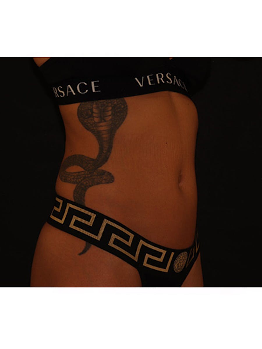 Emsculpt Neo Before & After Gallery - Patient 877249 - Image 7