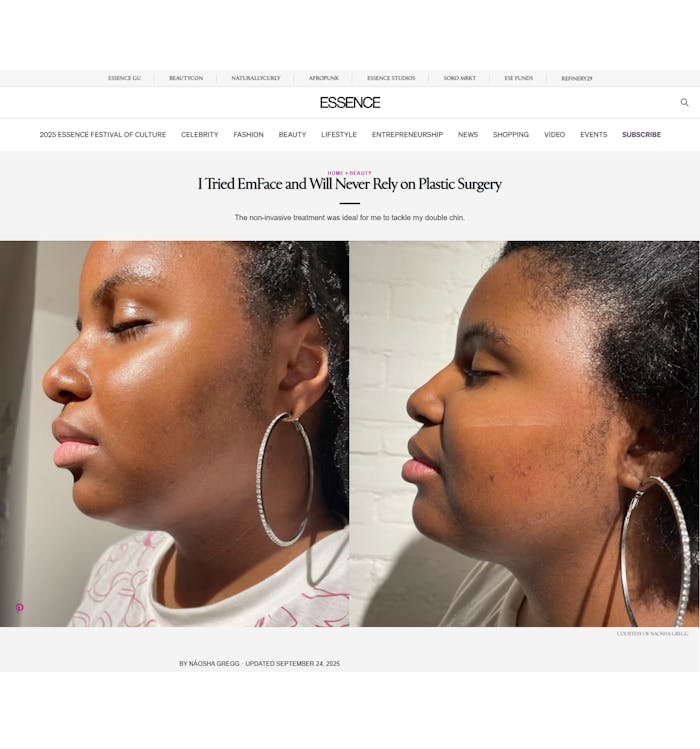 Dr. Halaas featured in Essence Article on EmFace