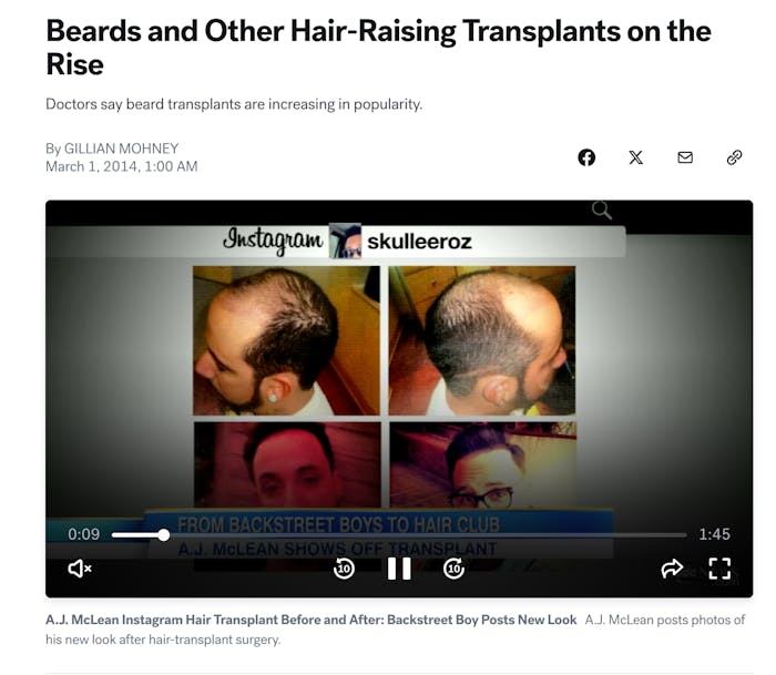 Beards and Other Hair-Raising Transplants on the Rise