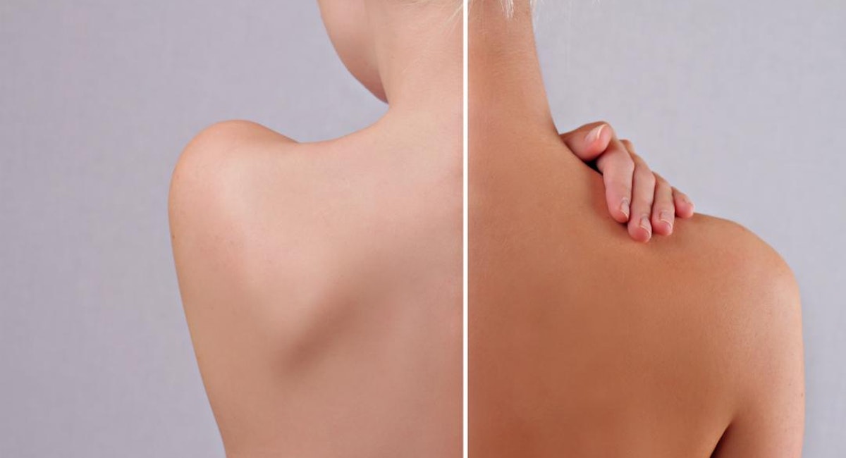 Before and after spray tan