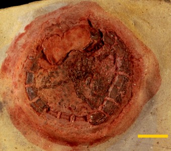 Echinodermata - Edrioasteroidea -
Savagella illinoisensis Specimen PE 25563
Orchard Creek Formation
Paleozoic - Late Ordovician
Thebes, Illinois