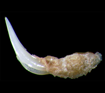 Macro image of one of the few venom apparatuses in fishes that is not a dorsal spine. In the fangtooth blennies, a paired set of fangs carries the venom from the beige sack down the grooved tooth and into the prey item.