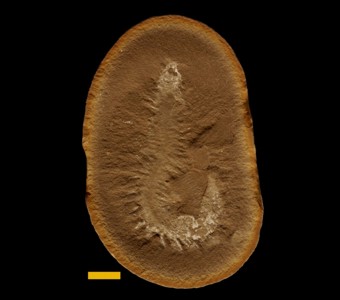 Annelida - Polychaeta - Phyllodocida
 
Dryptoscolex matthiesaeSpecimen PE 12491
Carbondale Formation - Francis Creek Shale Member
Paleozoic - Middle Pennsylvanian (~305 million years old)
Mazon Creek Area, Illinois