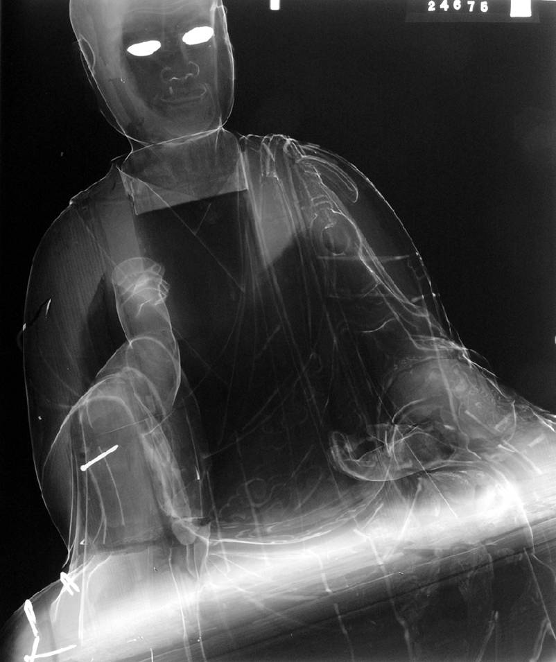 Film X-radiograph of the statue shows that the eyes are  very attenuating, that there are metal nails and staples added to the structure, and suggests that the interiors of the torso and the head are hollow.  The metal elements are probably part of an attempt to 'repair' the statue after the wood elements began to separate. The highly attenuating eyes are puzzling.