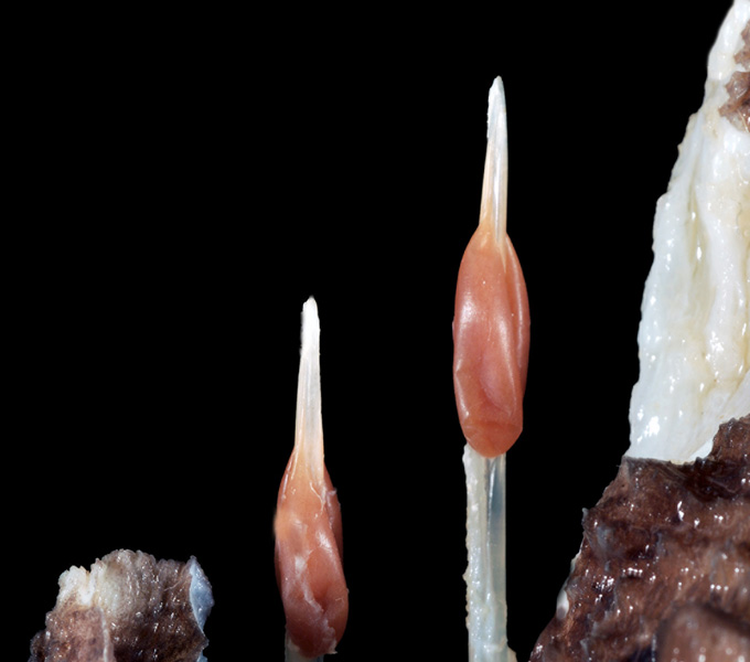 Macro image of the venomous dorsal-fin spine of the world's most venomous fish, the stonefish (Synanceia). The brown sacks along the bony spines hold the venom that is delivered through a hollow fin spine.