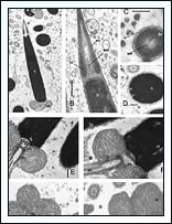 Image for PEET - Bivalves Project: Bivalve Sperm Ultrastructure