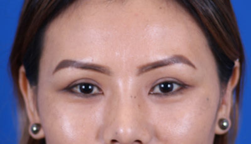 Omaha Facial Plastic Surgery & Medspa