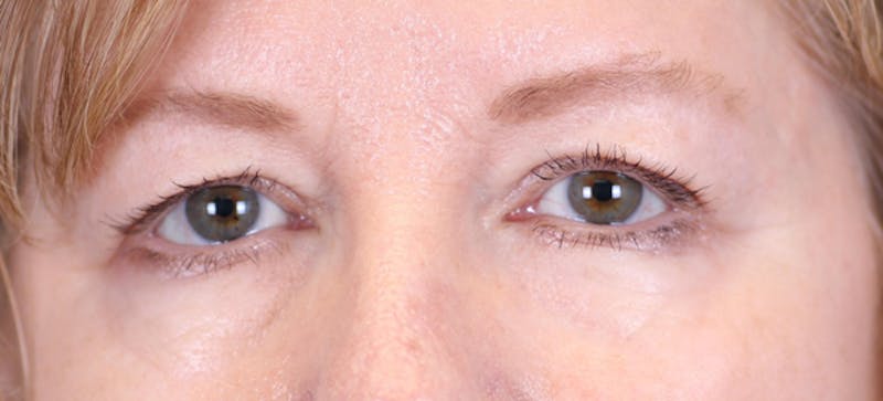 Omaha Facial Plastic Surgery & Medspa