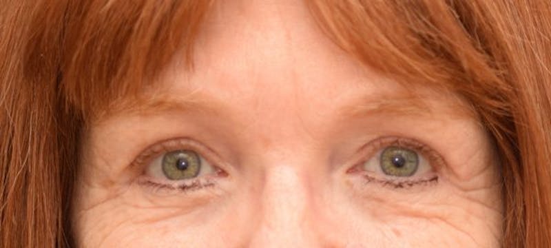 Omaha Facial Plastic Surgery & Medspa