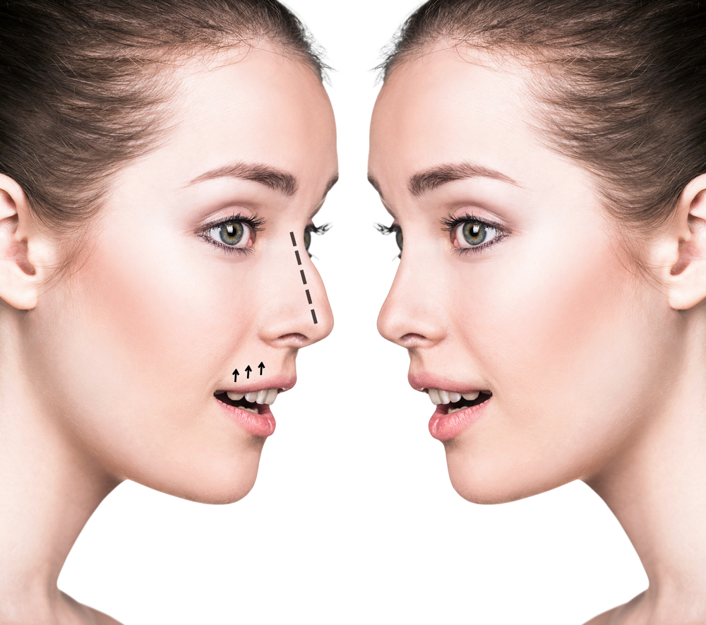 Omaha Facial Plastic Surgery & Medspa Blog | What Is the Best Age to Get a Nose Job?