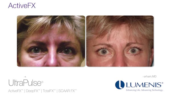 Slideshow video of before and after pictures from Laser Clinique patients..