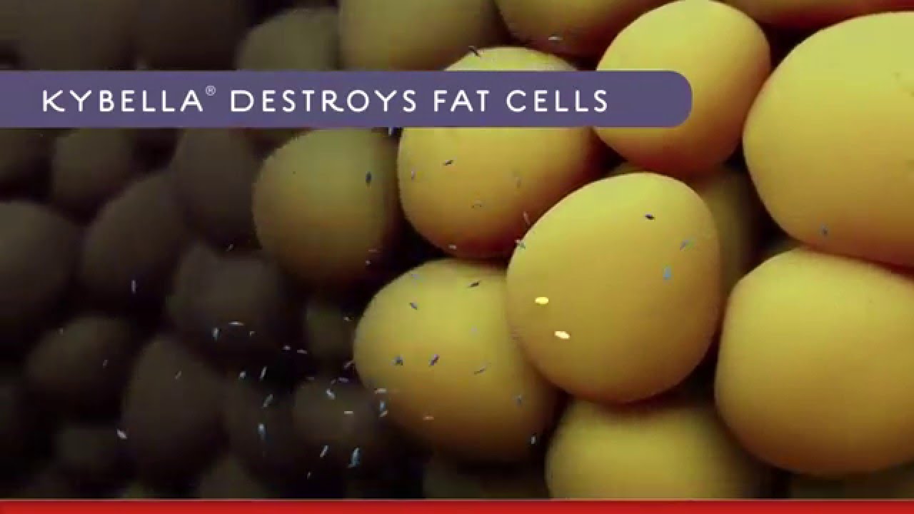 Video about how Kybella destroys fat cells.