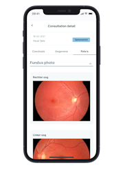 Eyehelp Patient App shown on iPhone