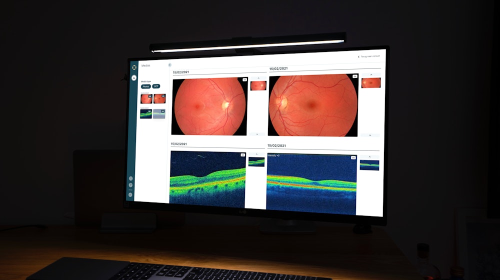 Computer screen showing Eyehelp app with patient data
