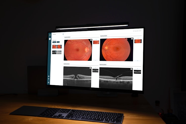 Eye doctor interface in Eyehelp showing patient's images.