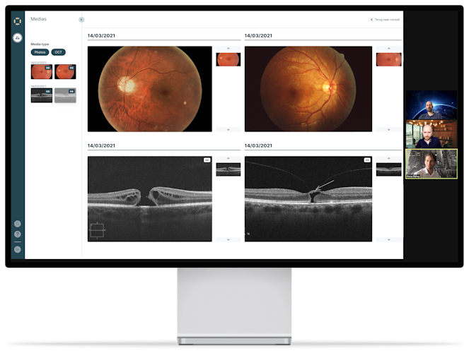 Beeldscherm met een trainingssessie met een van onze oogartsen.