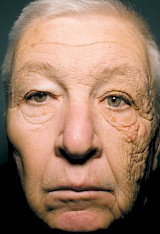 Raffi Hovsepian, MD Blog | Summer is Coming – Avoid Sun Damage