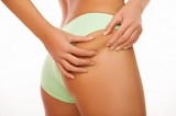 Raffi Hovsepian, MD Blog | Cellulite Reduction in Beverly Hills