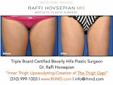 Raffi Hovsepian, MD Blog | The Thigh Gap Obsession! By Plastic Surgeon Dr. Raffi Hovsepian