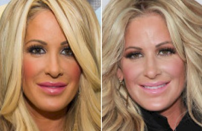 Raffi Hovsepian, MD Blog | A Little Nip And Tuck? Kim Zolciak Has Had 'A Nose Job And Botox,' Says Surgeon