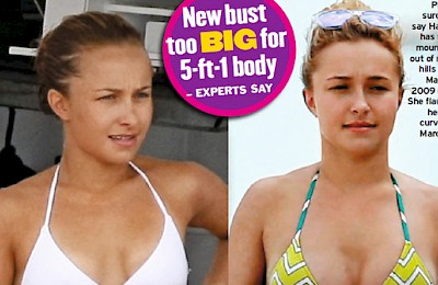 Raffi Hovsepian, MD Blog | Hayden Panettiere's Breast Augmentation