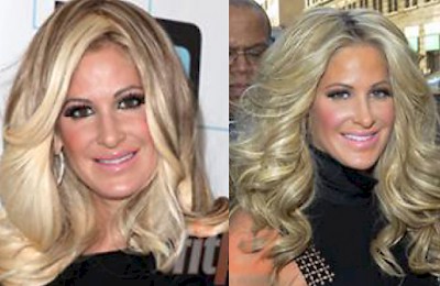 Raffi Hovsepian, MD Blog | Kim Zolciak Got Botox & A Nose Job???