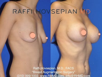 Procedures (old) Before & After Gallery - Patient 74399773 - Image 1