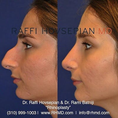 Procedures (old) Before & After Gallery - Patient 74399861 - Image 1